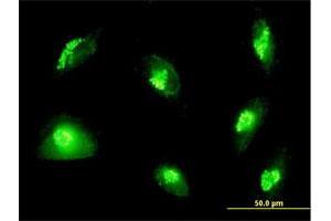 Immunofluorescence of purified MaxPab antibody to GOLGA2 on HepG2 cell. (Golgin A2 (GOLGA2) (AA 1-990) anticorps)