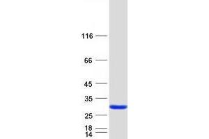 Validation with Western Blot