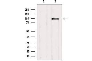 Western blot analysis of extracts from HuvEc, using IGF1R Antibody.