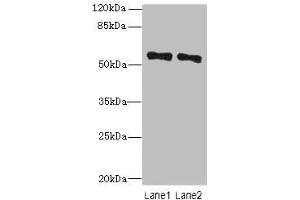 Western blot All lanes: ZNF689 antibody at 5 μg/mL Lane 1: Hela whole cell lysate Lane 2: HepG2 whole cell lysate Secondary Goat polyclonal to rabbit IgG at 1/10000 dilution Predicted band size: 57 kDa Observed band size: 57 kDa (ZNF689 anticorps  (AA 1-300))