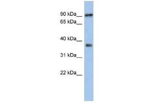 WB Suggested Anti-RSPH10B Antibody Titration: 0. (RSPH10B anticorps  (Middle Region))