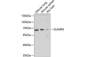 Western blot analysis of extracts of various cell lines using SLAMF6 Polyclonal Antibody at dilution of 1:1000. (SLAMF6 anticorps)