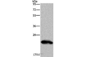 Western blot analysis of Human placenta tissue, using GH2 Polyclonal Antibody at dilution of 1:500 (Growth Hormone 2 anticorps)