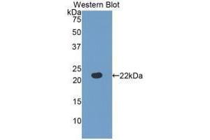 Western blot analysis of the recombinant protein. (Fibulin 5 anticorps  (AA 277-448))