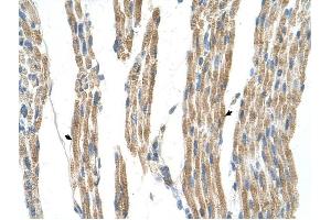 GPT antibody was used for immunohistochemistry at a concentration of 4-8 ug/ml to stain Skeletal muscle cells (arrows) in Human Muscle. (ALT anticorps)