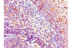 Immunohistochemistry of paraffin-embedded human tonsil tissue using ABIN7169428 at dilution of 1:100 (ASH2L anticorps  (AA 329-628))
