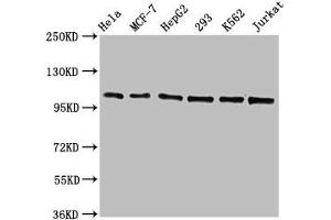 Western Blot Positive WB detected in: Hela whole cell lysate, MCF-7 whole cell lysate, HepG2 whole cell lysate, 293 whole cell lysate, K562 whole cell lysate, Jurkat whole cell lysate All lanes: CDC5L antibody at 1.