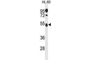 Western blot analysis of SPN Antibody (Center) in HL-60 cell line lysates (35µg/lane). (CD43 anticorps  (Middle Region))