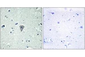 Immunohistochemistry analysis of paraffin-embedded human brain tissue, using ETBR2 Antibody. (ETBR2 anticorps  (AA 1-50))