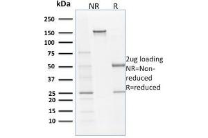 SDS-PAGE Analysis Purified Filaggrin Monoclonal Antibody (SPM181). (Filaggrin anticorps)