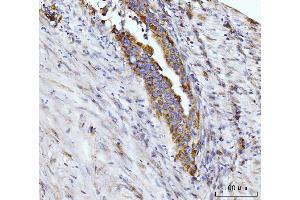 IHC analysis of Glutaminase/GLS using anti-Glutaminase/GLS antibody (ABIN7601602). (Glutaminase anticorps  (AA 396-654))