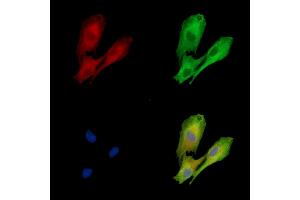 ABIN7096903 and ABIN7100969 staining  cells by IF/ICC. (DOLPP1 anticorps)