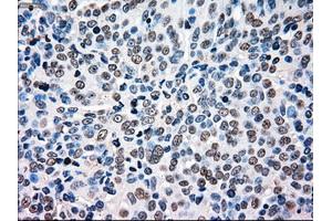 Immunohistochemistry (IHC) image for anti-B-Raf proto-oncogene, serine/threonine kinase (BRAF) antibody (ABIN1496954) (BRAF anticorps)