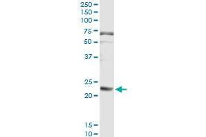 Immunoprecipitation of FGA transfected lysate using anti-FGA monoclonal antibody and Protein A Magnetic Bead , and immunoblotted with FGA MaxPab rabbit polyclonal antibody.