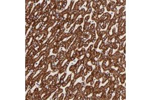Immunohistochemical staining of human liver with ECH1 polyclonal antibody  shows strong cytoplasmic positivity in hepatocytes. (ECH1 anticorps)