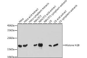 Western blot analysis of extracts of various cell lines, using Histone H2B antibody (ABIN7267736) at 1:1000 dilution.