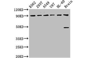 Western Blot Positive WB detected in: K562 whole cell lysate, 293T whole cell lysate, A549 whole cell lysate, U87 whole cell lysate, HL60 whole cell lysate, Rat brain tissue All lanes: OCA2 antibody at 8. (OCA2 anticorps  (AA 2-136))