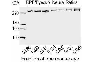 Immunoblot for ABCA4 protein using neural retina and RPE/eyecup homogenates loaded as a fraction of one mouse eye per lane, as indicated. (ABCA4 anticorps  (AA 2250-2263))