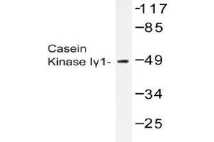 Western blot (WB) analysis of Casein Kinase Igamma1 antibody in extracts from COS-7 cells. (CSNK1G1 anticorps)