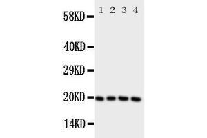 Western Blotting (WB) image for anti-Lipocalin 1 (LCN1) (AA 110-124), (Middle Region) antibody (ABIN3043125) (Lipocalin 1 anticorps  (Middle Region))