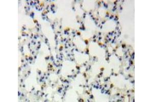 IHC-P analysis of Lung tissue, with DAB staining. (CLIC4 anticorps  (AA 104-253))