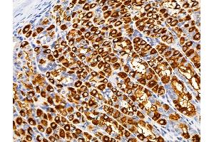 ABIN6259968 and ABIN6266497 at 1/100 staining Rat stomach tissue by IHC-P. (APAF1 anticorps  (C-Term))
