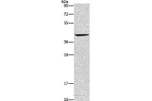 Western blot analysis of Mouse liver tissue, using ORM2 Polyclonal Antibody at dilution of 1:500 (Orosomucoid 2 anticorps)