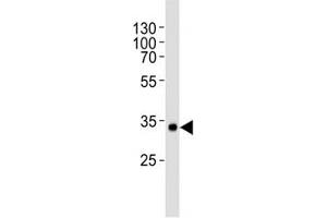 Western blot analysis of human recombinant protein using vWF antibody at 1:1000.
