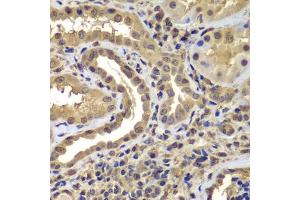 Immunohistochemistry of paraffin-embedded human kidney using PSMB8 antibody (ABIN5975113) at dilution of 1/100 (40x lens).