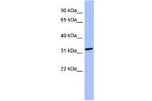 Image no. 1 for anti-Melanoma Antigen Family B, 2 (MAGEB2) (N-Term) antibody (ABIN6744050) (MAGEB2 anticorps  (N-Term))