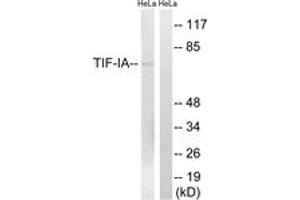 Western blot analysis of extracts from HeLa cells, treated with calyculinA 50ng/ml 30', using TIF-IA (Ab-649) Antibody. (RRN3 anticorps  (AA 602-651))