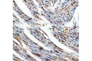 IHC analysis of CD31/Pecam1 using anti-CD31/Pecam1 antibody (ABIN7601662). (CD31 anticorps  (AA 41-258))