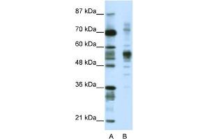 WB Suggested Anti-CORO1A Antibody Titration:  1. (Coronin 1a anticorps  (C-Term))