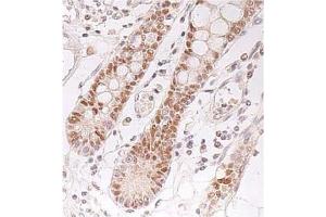 Immunohistochemistry (IHC) image for anti-Checkpoint Kinase 2 (CHEK2) antibody (ABIN487488) (CHEK2 anticorps)