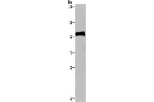 Western Blotting (WB) image for anti-Plasminogen (PLG) antibody (ABIN2435220)