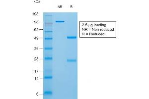 SDS-PAGE Analysis of Purified Thyroglobulin Rabbit Recombinant Monoclonal Antibody (TGB/1970R).