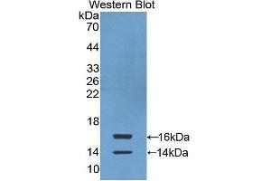 Western Blotting (WB) image for anti-Chemokine (C-C Motif) Ligand 24 (CCL24) antibody (FITC) (ABIN1862929) (CCL24 anticorps  (FITC))