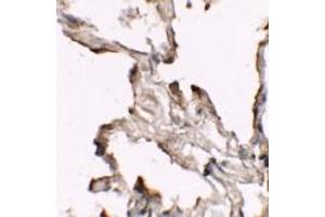 Immunohistochemistry of NIBRIN in human lung tissue with NIBRIN antibody (C-term) Cat.