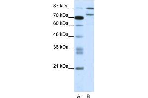 WB Suggested Anti-ZNF709 Antibody Titration:  2. (ZNF709 anticorps  (N-Term))