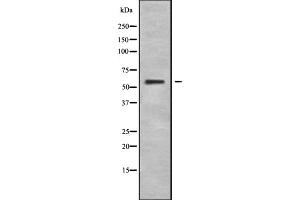 Western blot analysis IL28RA using HeLa whole cell lysates
