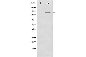 Western blot analysis of Abl phosphorylation expression in Adriamycin treated COS7 whole cell lysates,The lane on the left is treated with the antigen-specific peptide.
