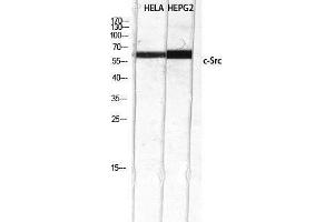 Western Blotting (WB) image for anti-Proto-oncogene tyrosine-protein kinase Src (Src) (Tyr1172) antibody (ABIN3174587) (Src anticorps  (Tyr1172))