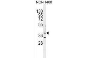 Western Blotting (WB) image for anti-UDP-Gal:betaGlcNAc beta 1,3-Galactosyltransferase, Polypeptide 5 (B3GALT5) antibody (ABIN2996041) (B3GALT5 anticorps)