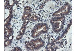 Image no. 5 for anti-Archain 1 (ARCN1) antibody (ABIN1497571)