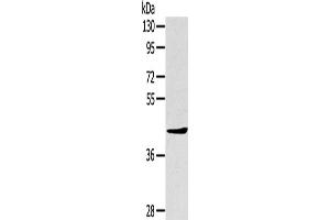 Western Blotting (WB) image for anti-TNFAIP3 Interacting Protein 2 (TNIP2) antibody (ABIN2427434) (TNIP2 anticorps)