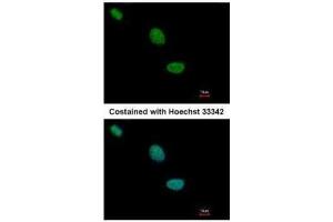 ICC/IF Image Immunofluorescence analysis of paraformaldehyde-fixed HeLa, using TLE2, antibody at 1:500 dilution. (TLE2 anticorps  (C-Term))
