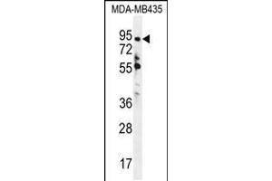 Western blot analysis in MDA-MB435 cell line lysates (35ug/lane). (ZNF605 anticorps  (N-Term))