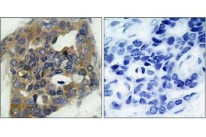 Image no. 1 for anti-Mitogen-Activated Protein Kinase Kinase Kinase 5 (MAP3K5) (pSer966) antibody (ABIN196915) (ASK1 anticorps  (pSer966))