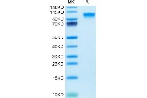 SDS-PAGE (SDS) image for Interleukin 17 Receptor A (IL17RA) (AA 32-322) protein (Fc Tag) (ABIN7274244)