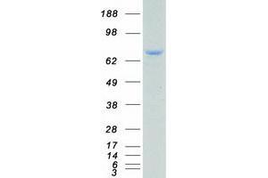 Validation with Western Blot